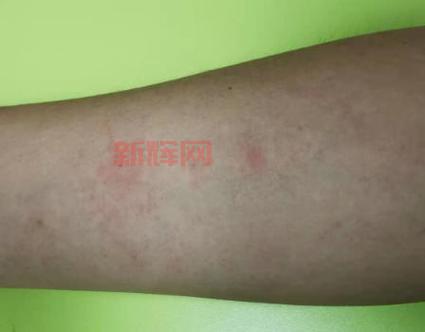 床上的螨虫:识别方法与健康隐患解析