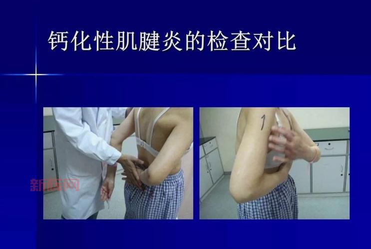 英雄联盟鳄鱼征服者天赋怎么点?看完这篇就懂了!