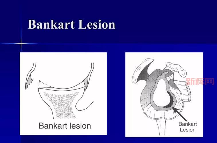 英雄联盟鳄鱼征服者天赋怎么点?看完这篇就懂了!